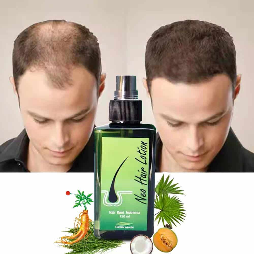 Neo Hair Lotion for Hair Growth and Thickening original 120ml المنتج أصلي بنسبة 100٪، وإذا لم تحصل على النتيجة المطلوبة يمكنك إرجاعه.